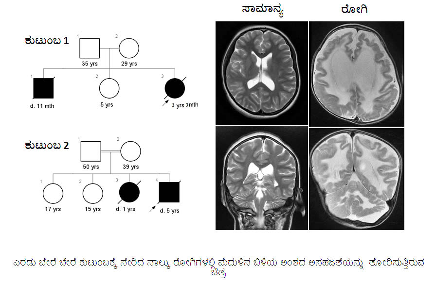 ಮಣಿಪಾಲ ವೈದ್ಯರಿಂದ ಹೊಸ ವಂಶವಾಹಿ ರೋಗಗಳ ಪತ್ತೆ